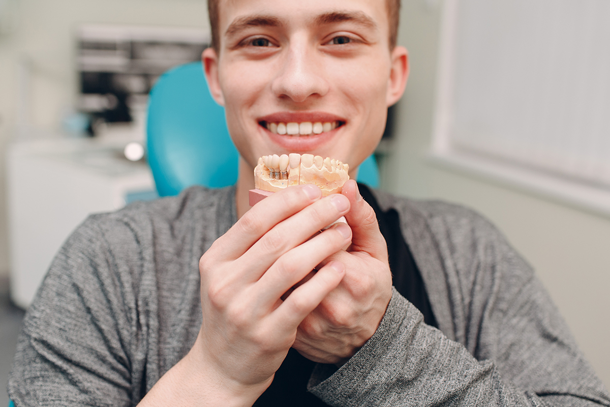 Implantes dentários 